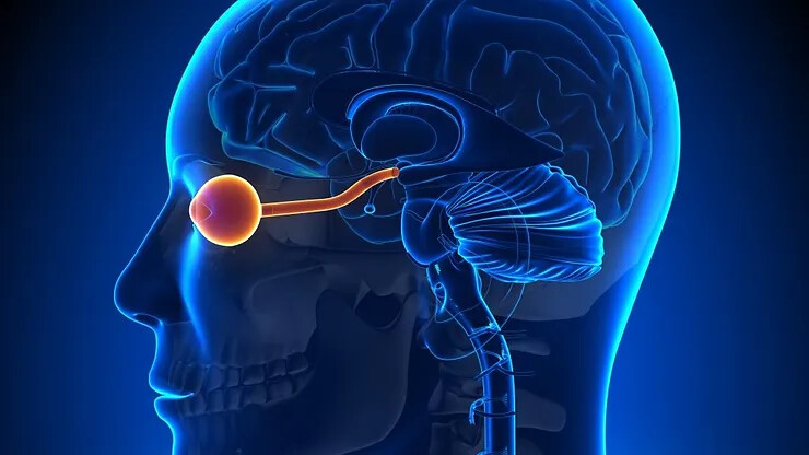 Neuromielite óptica: doença autoimune rara tem diagnóstico complexo