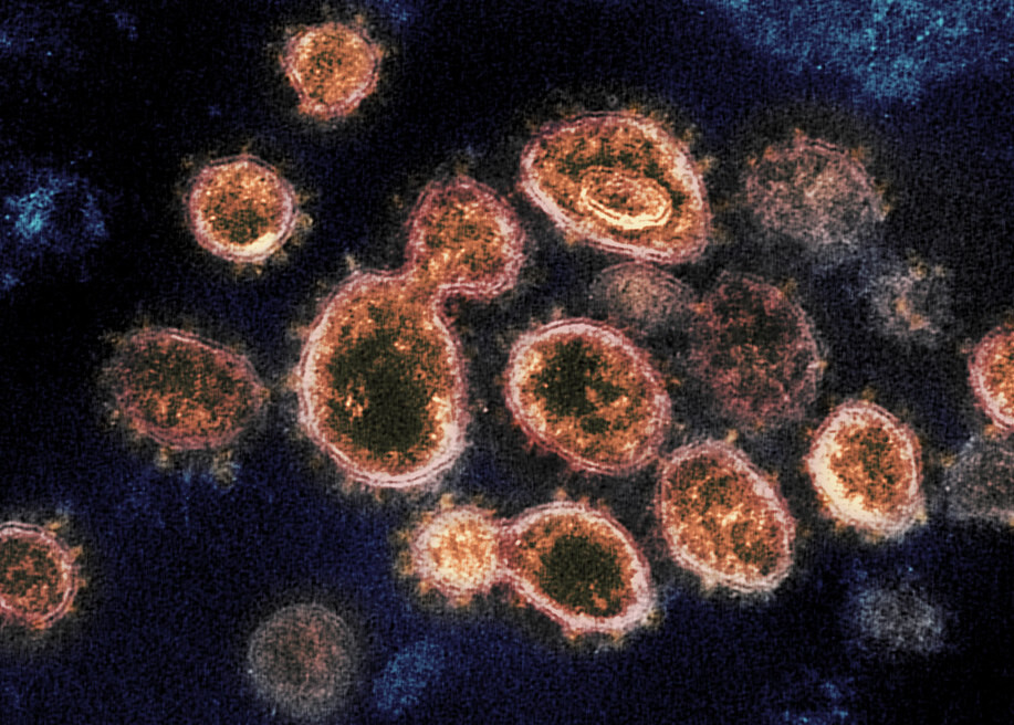 Brasil tem 96,5 mil casos de coronavírus e 6,7 mil mortes registradas
