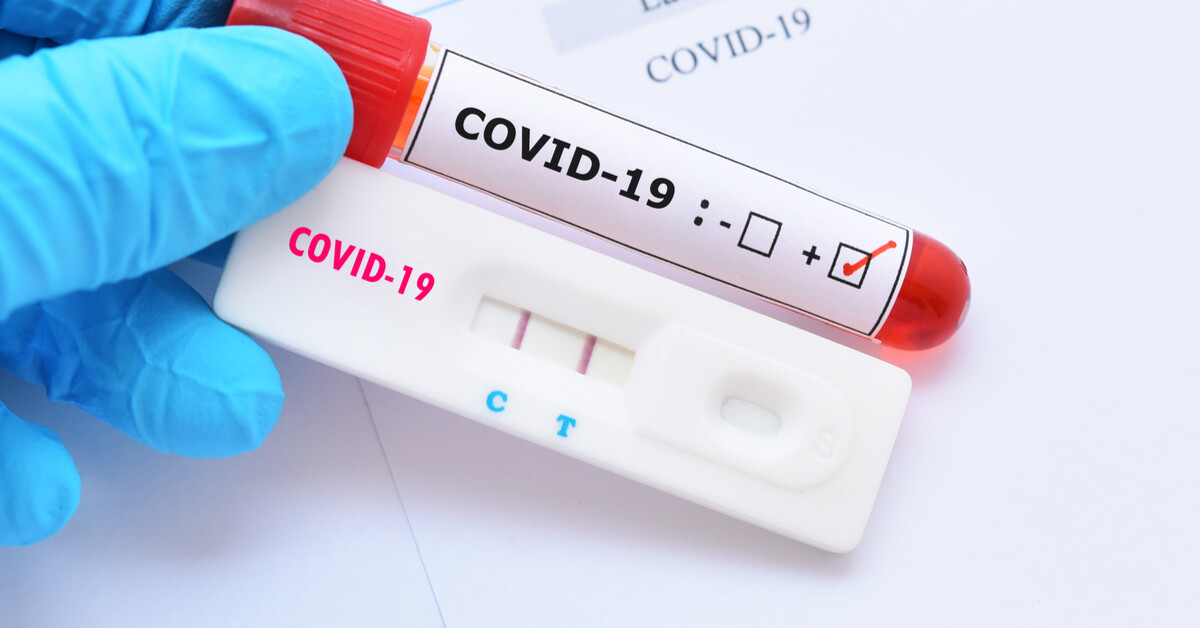 Covid-19: testes têm variação de preços de até 60%