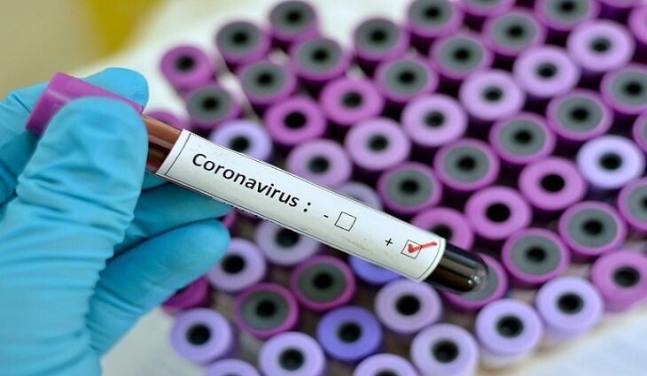 Pesquisa da UFMG desenvolve teste que detecta Covid-19 pela urina