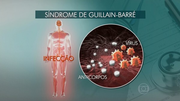 Anvisa alerta sobre casos raros de Guillain-Barré após vacinação